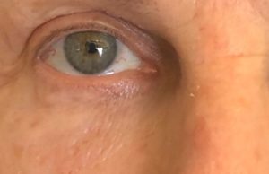 SKIN REJUVENATION SERVICES 32 Get Agnes treatment at Halina Spa in Round Rock & Austin, TX.